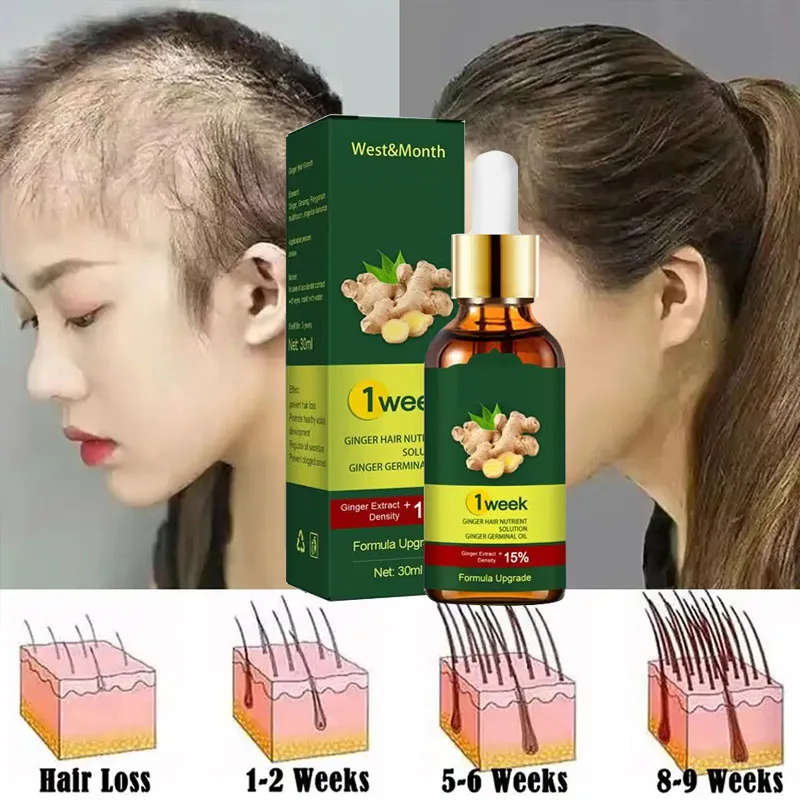 Licorice Root Sticks - 7 Dagen Gember Haargroeiproducten Bevorderen Snel