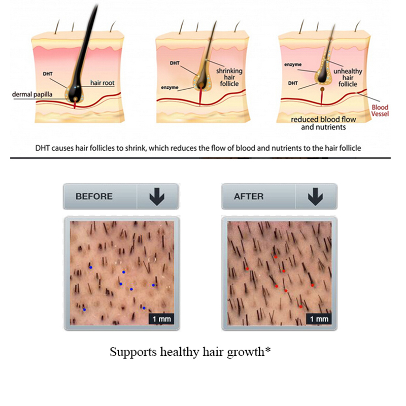 PURC Gember Haaruitval Shampoo - Licorice Root Sticks recensie en prijs